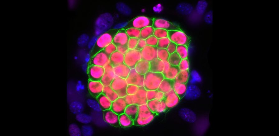 Houston researchers reveal guardian of the stem cell genome